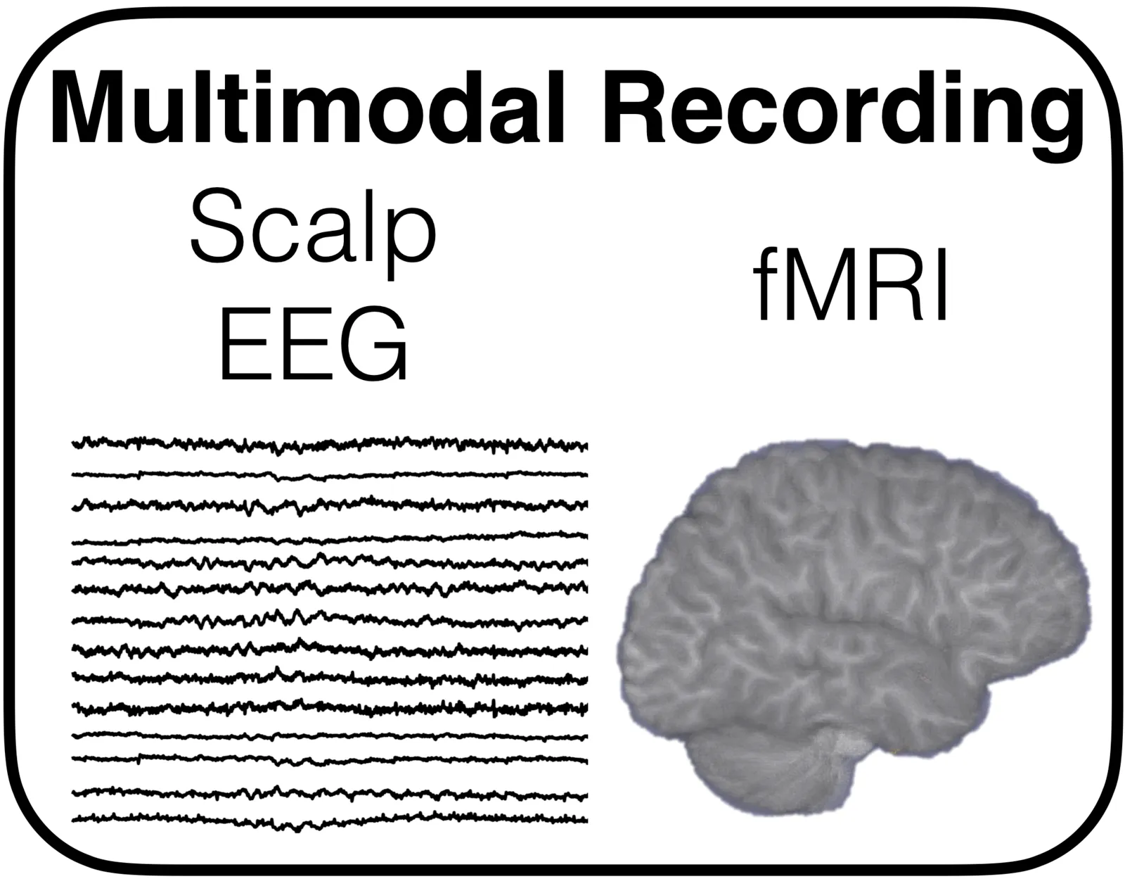 Comparison of EEG and fMRI recording, contrasting EEG’s high temporal resolution with fMRI’s high spatial resolution.